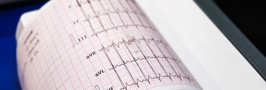 A thermal printer mechanism used in a patient monitoring device for healthcare.